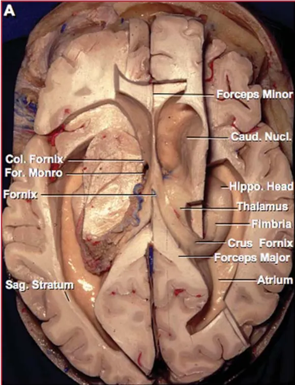 Co.' oml Minor å!amus Imb a Fornlx mgm Wnor Cap. — (ROD Sag. HWpo. Caud. Nucl. Thalunus Forceps Major 