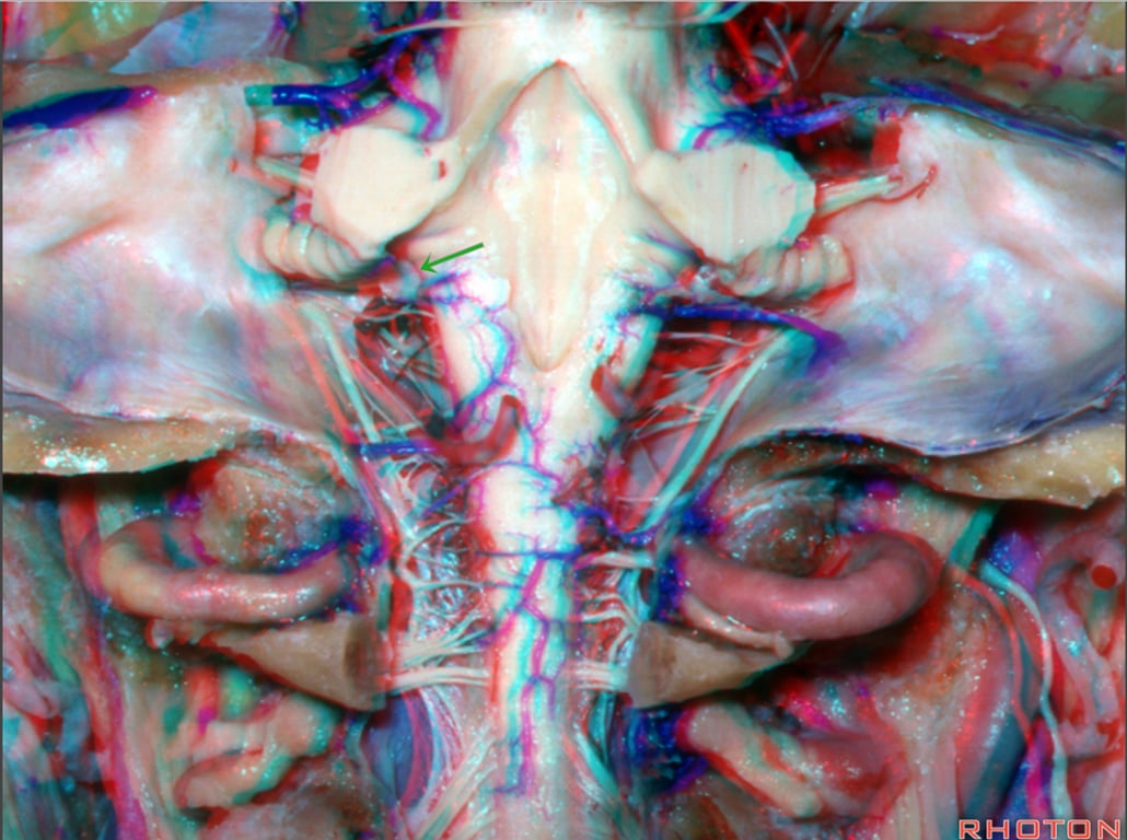 A close-up of a human body AI-generated content may be incorrect.