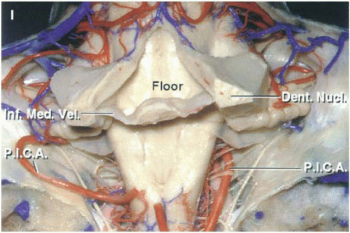 Floor اان االاا ، 
