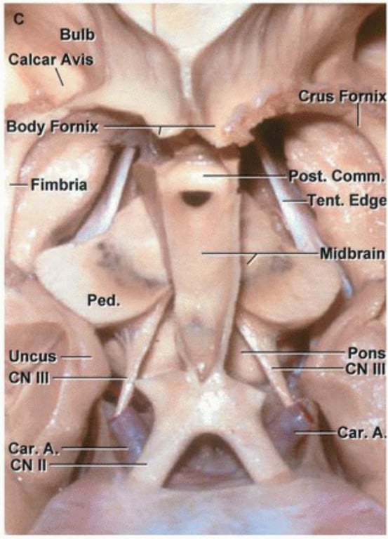 Bulb Calcar AVIS Body 'Crus Forni ix ost. Comm Fimbria ent Ed i brai ped. Uncus — CN 111 Car. Car. A. N 11 