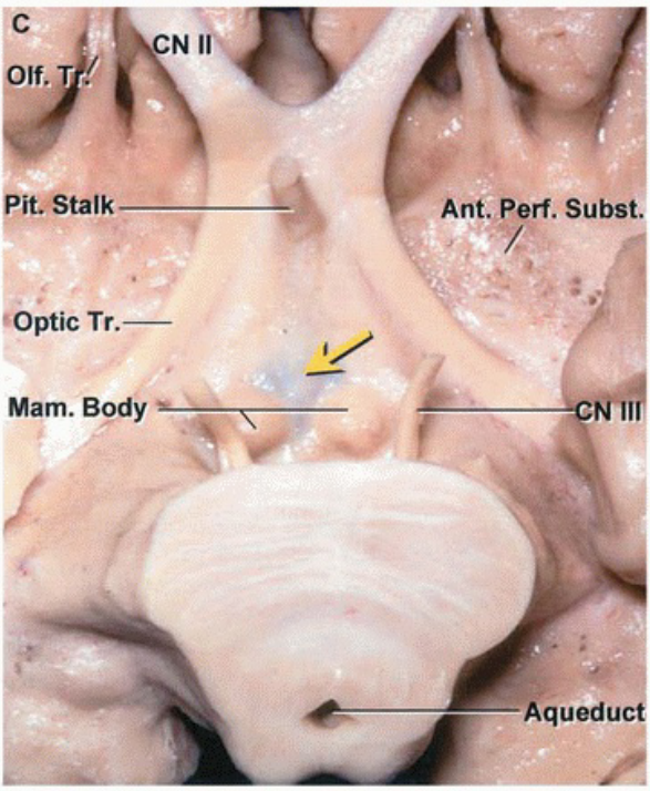 'Optic Tr.— Mam. Body Aquedu 