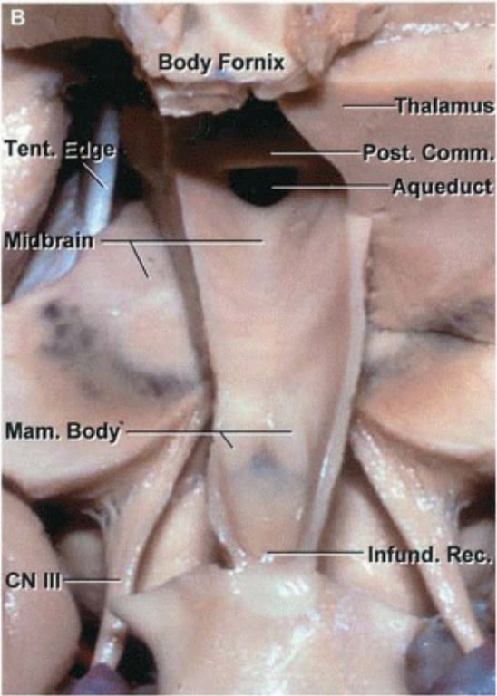 Tent. rain Mam. Body• CN Ill Body Fornix —Thalam Post. Com Aquedu d. Re 