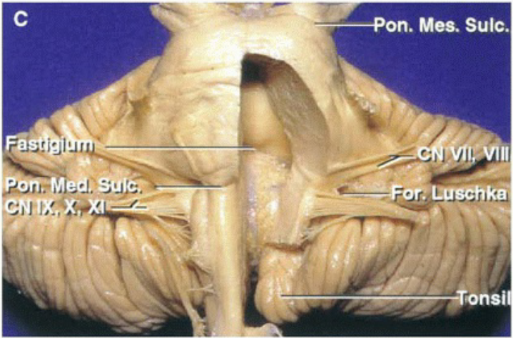 ايزلة- "أ .،ا زلازة .Pon—E5*7 .es. .Sulc ال يتد 