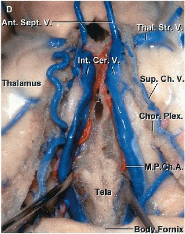 nt. Sept. y Int. ceé, v. Thalamus Tela A up. Ch. V. Cho Plex. B "Fornix 