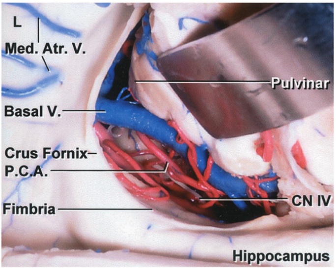 ed. Atr. V. Basal V. Crus F mix— kimbria uJ'/jn: ocampus 