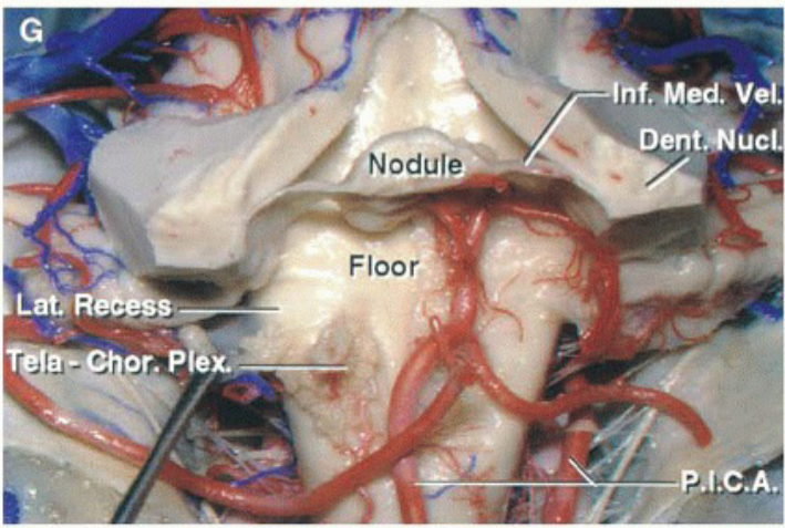/NoduIe Floor . Meæ. Vel. PÆ+.A. 