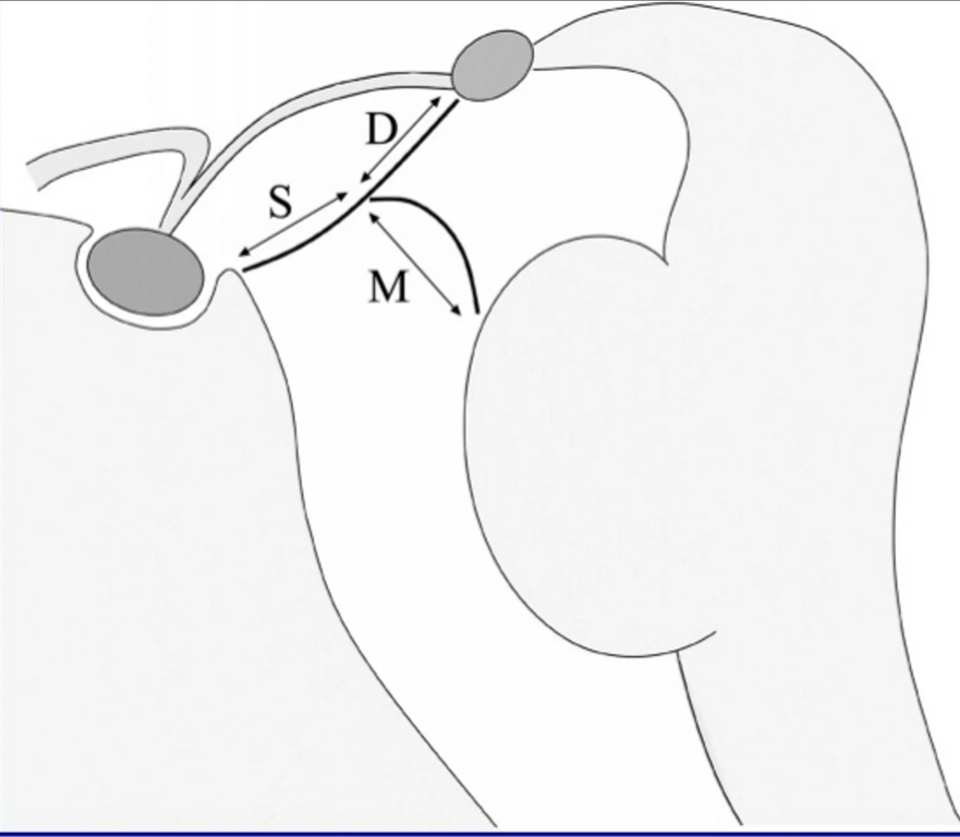 S: Sellar; D, Diencephalic; M, Mesencephalis