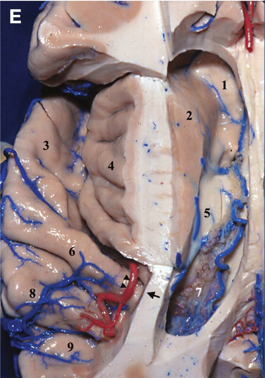 A close-up of a human brain AI-generated content may be incorrect.