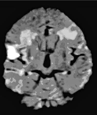 A close-up of a brain scan AI-generated content may be incorrect.