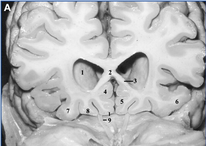 A close-up of a brain AI-generated content may be incorrect.