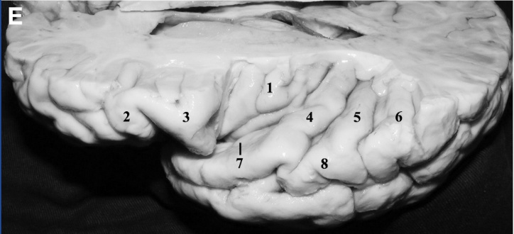 A close-up of a human jaw AI-generated content may be incorrect.
