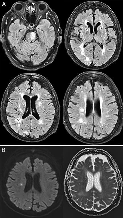 A close-up of a brain scan AI-generated content may be incorrect.