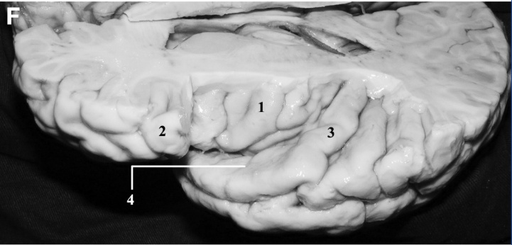 A close-up of a human brain AI-generated content may be incorrect.