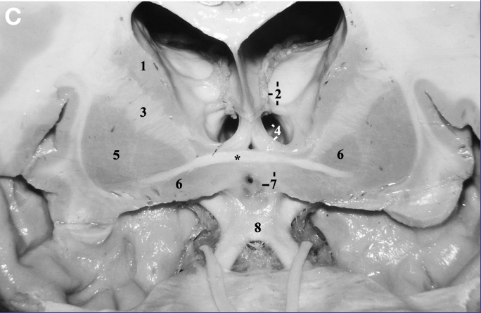 A close-up of the inside of a human body AI-generated content may be incorrect.