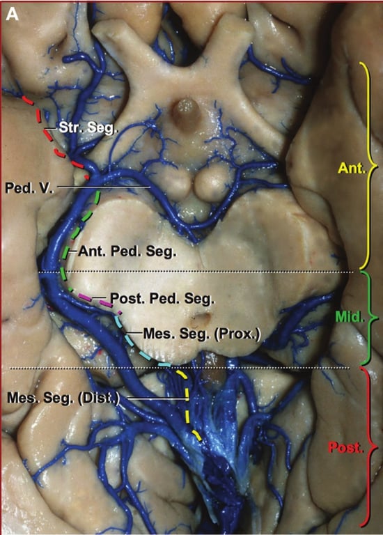 Ant. Ant. Ped. Seg. .tost. Ped. Seg. Mes. Ség. (Prox.) seg. (D 