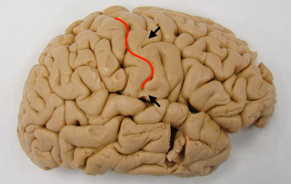 A close-up of a brain AI-generated content may be incorrect.