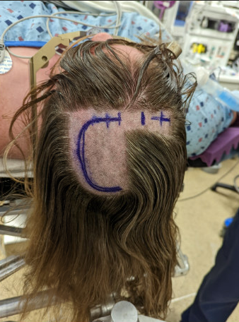 Figure 1: Dr. Jorge Gonzalez-Martinez