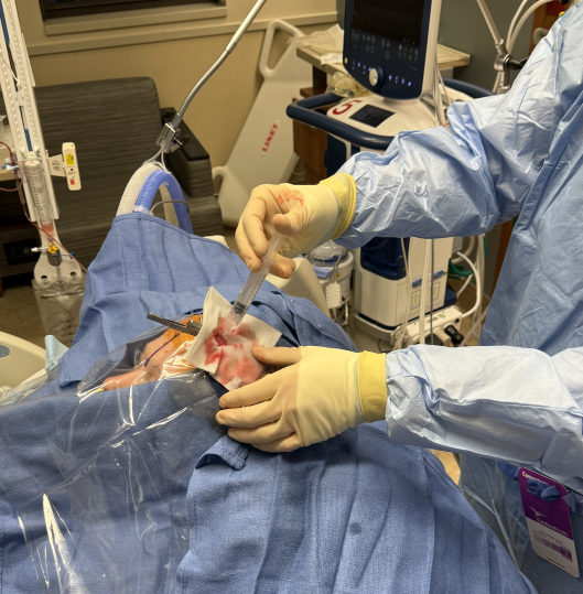 Dealing with venous bleeding - cover the craniostomy with a 4x4 and just tamponade with flush