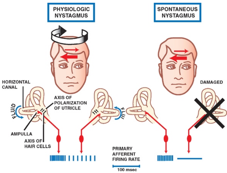 SPONTANEOUS NYSTAGMUS HORIZONTAL 3 AMPULLA AXIS OF HAIR CELLS PHYSIOLOGIC NYSTAGMUS AXIS OF POLARIZATION OF UTRICLE PRIMARY AFFERENT FIRING RATE 