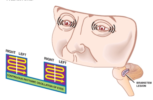 A close-up of a person's face AI-generated content may be incorrect.