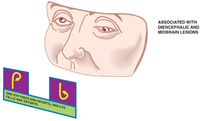 Nlvueol" ONV HUM auvloossv 