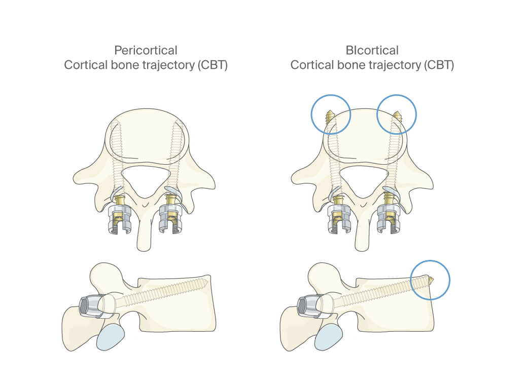 A diagram of a bone Description automatically generated