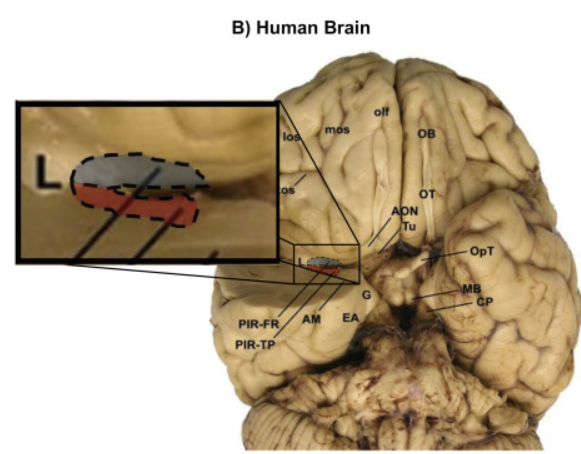 В) Нитап Brain 