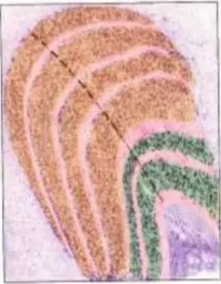 LGN - showing six cellular layers. Magnocellular (green) and Parvocellular (brown). layers are tiny neurons ventral to each layer. 