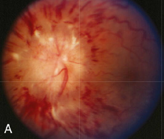 Close-up of a red and white sphere AI-generated content may be incorrect.