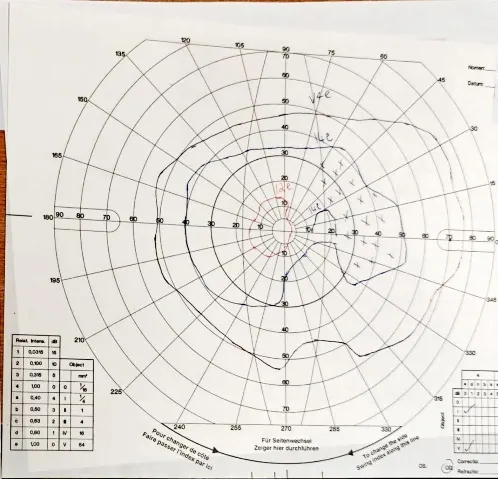 A diagram of a radar AI-generated content may be incorrect.