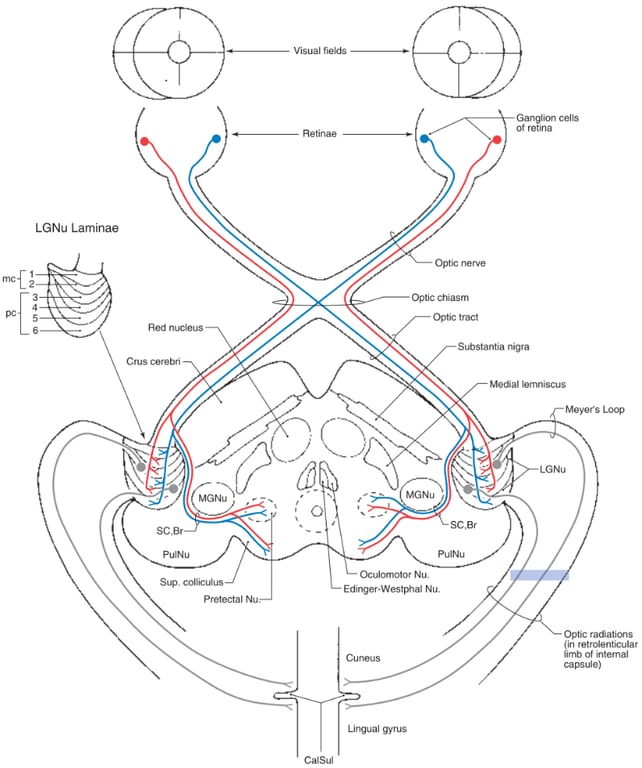 LGNu Laminae Red Crus cerebri MGNu pulNu pretectal Nu. Of Optic nerve Optic chiasm Optic tract Substantia nigra Medial lemniscus Meyers Loop MGNu sc.Br PulNu Oculomotor Nu. Optic radiations in retrolenticular [mb of internal capsule) LirV gyruS 