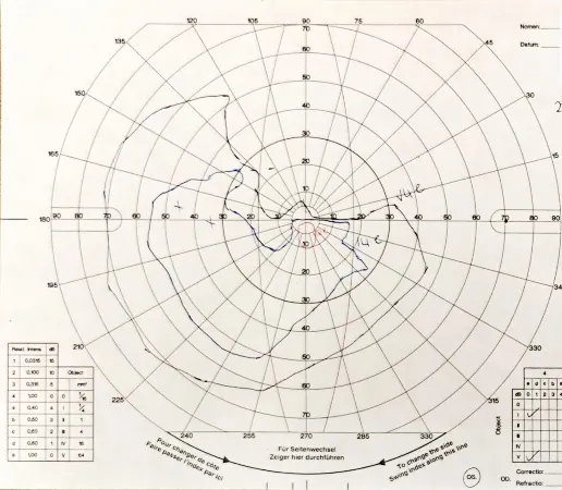 A diagram of a radar AI-generated content may be incorrect.