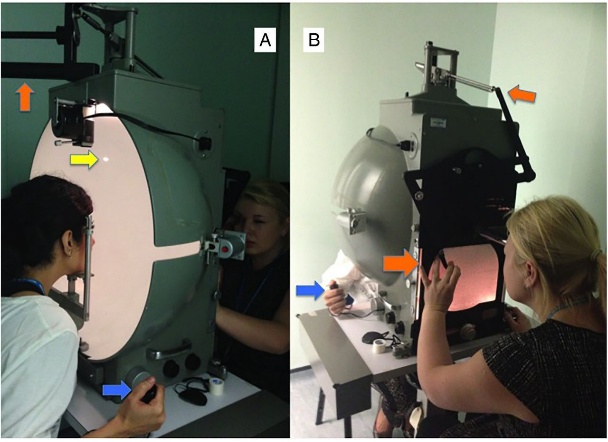 How to interpret visual fields | Practical Neurology