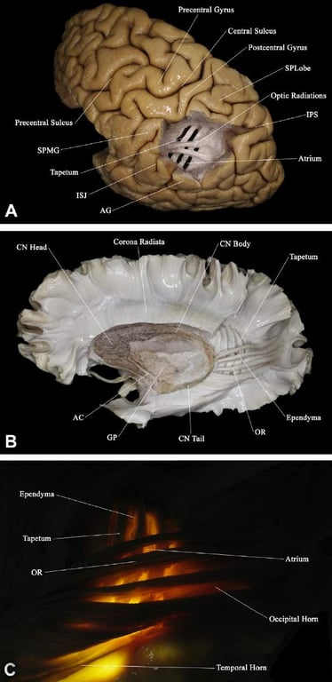 tuoH Ivaodtual u.oH tun!XIV euuÂpuadg urnpdea„ suoye!peu agdO sruKD snorns stuK9 NO peaH NO euoxoo rsl ultuadel DMS sn31ns 