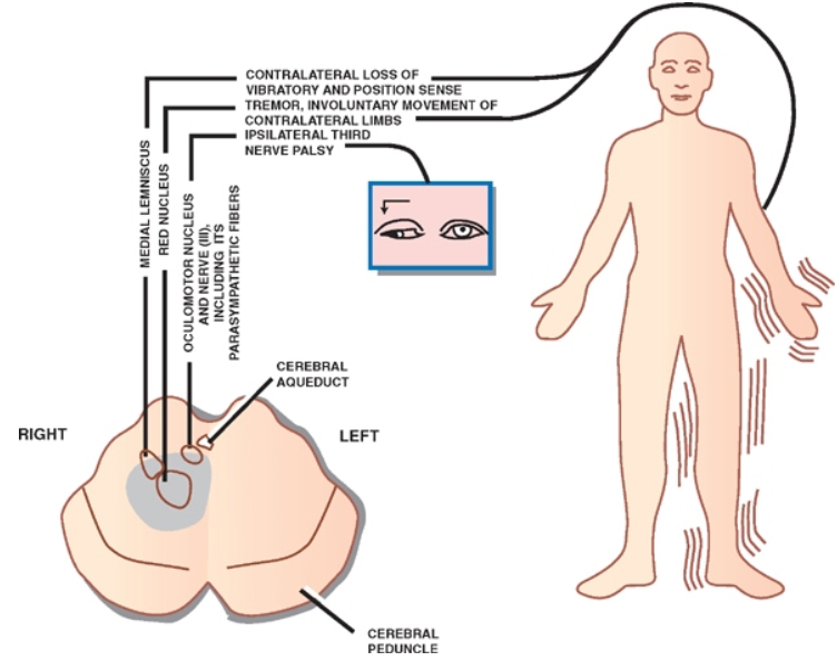 、 01 ′ 3 ー 編 ′ 0 、 エ 、 1 第 コ 10 、 ・ エ 0 ー 3 工 1 ↓ : 5 第 0 一 - デ 0d0 ま 、 A 工 01 、 エ ′ 、 0 第 ・ 011 、 エ 編 1 、 1 、 エ 1 第 00 第 エ ー 」 」 、 エ 編 1 、 、 、 エ 1 要 00 0 工 ま 1 」 、 エ 3 安 ョ 9 ま 、 動 り 一 一 0n10 肩 1F1 、 ト ( 取 0W01000 