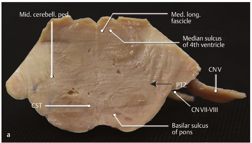 A close-up of a piece of meat AI-generated content may be incorrect.