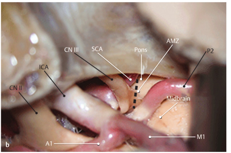 Close-up of a human body AI-generated content may be incorrect.