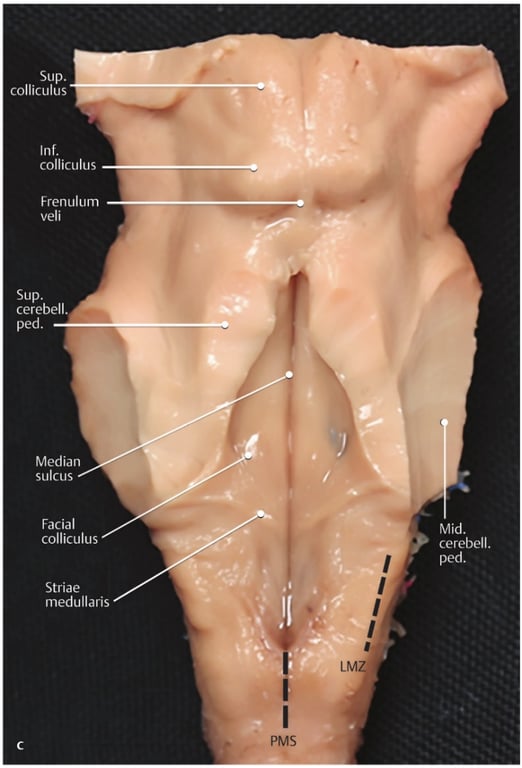 A close-up of a human body AI-generated content may be incorrect.
