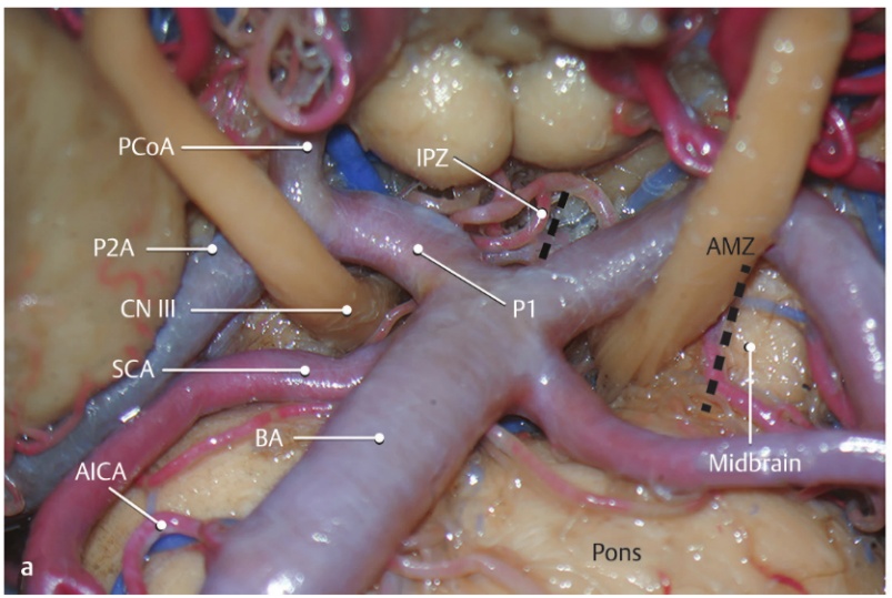 Close-up of a human body anatomy AI-generated content may be incorrect.