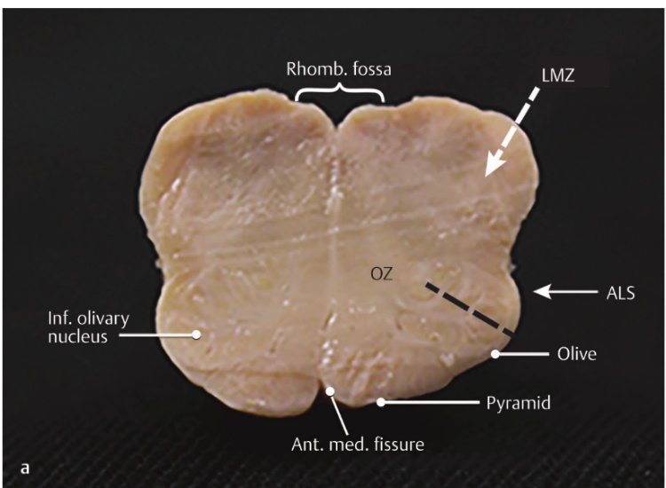 A close-up of a piece of meat AI-generated content may be incorrect.