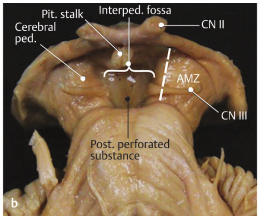 A close-up of a human body AI-generated content may be incorrect.