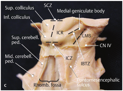 A close-up of a human body AI-generated content may be incorrect.