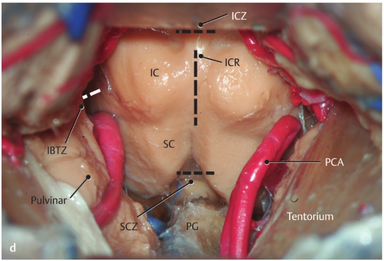 A close-up of a human body AI-generated content may be incorrect.
