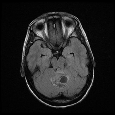 A mri of a brain AI-generated content may be incorrect.