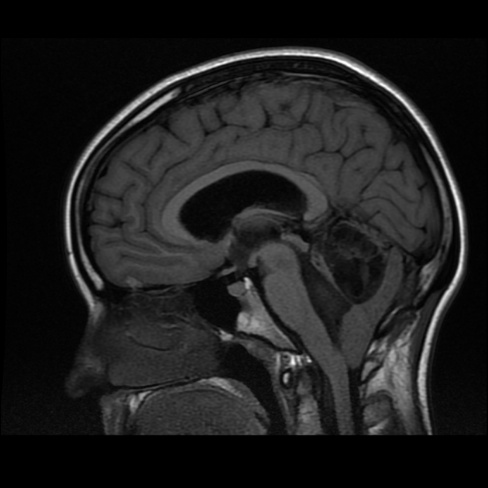 A close-up of a brain scan AI-generated content may be incorrect.