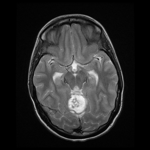 A close-up of a brain scan AI-generated content may be incorrect.