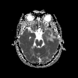 A close-up of a brain scan AI-generated content may be incorrect.