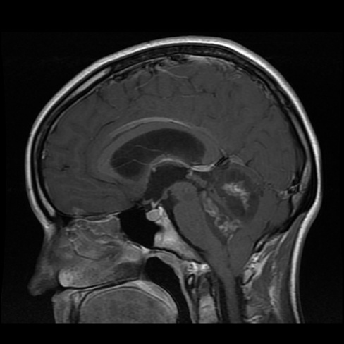 A close-up of a brain mri AI-generated content may be incorrect.