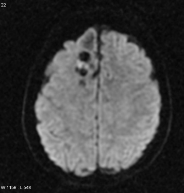 A brain scan of a person AI-generated content may be incorrect.