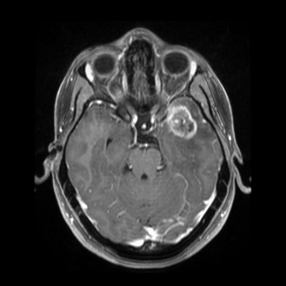 A close-up of a mri scan AI-generated content may be incorrect.